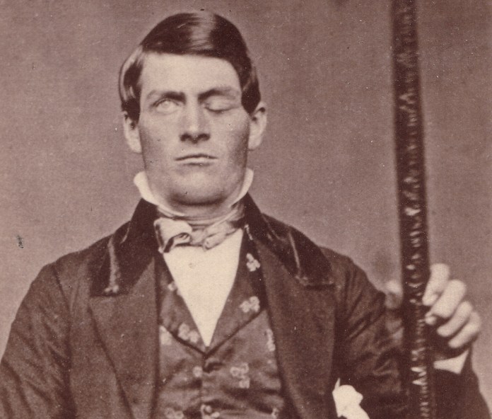 La storia di Phineas Gage, il più grande mistero della neuroscienza
